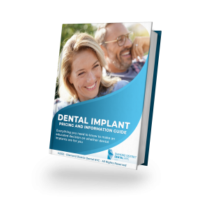Dental Implant Guide PDF
